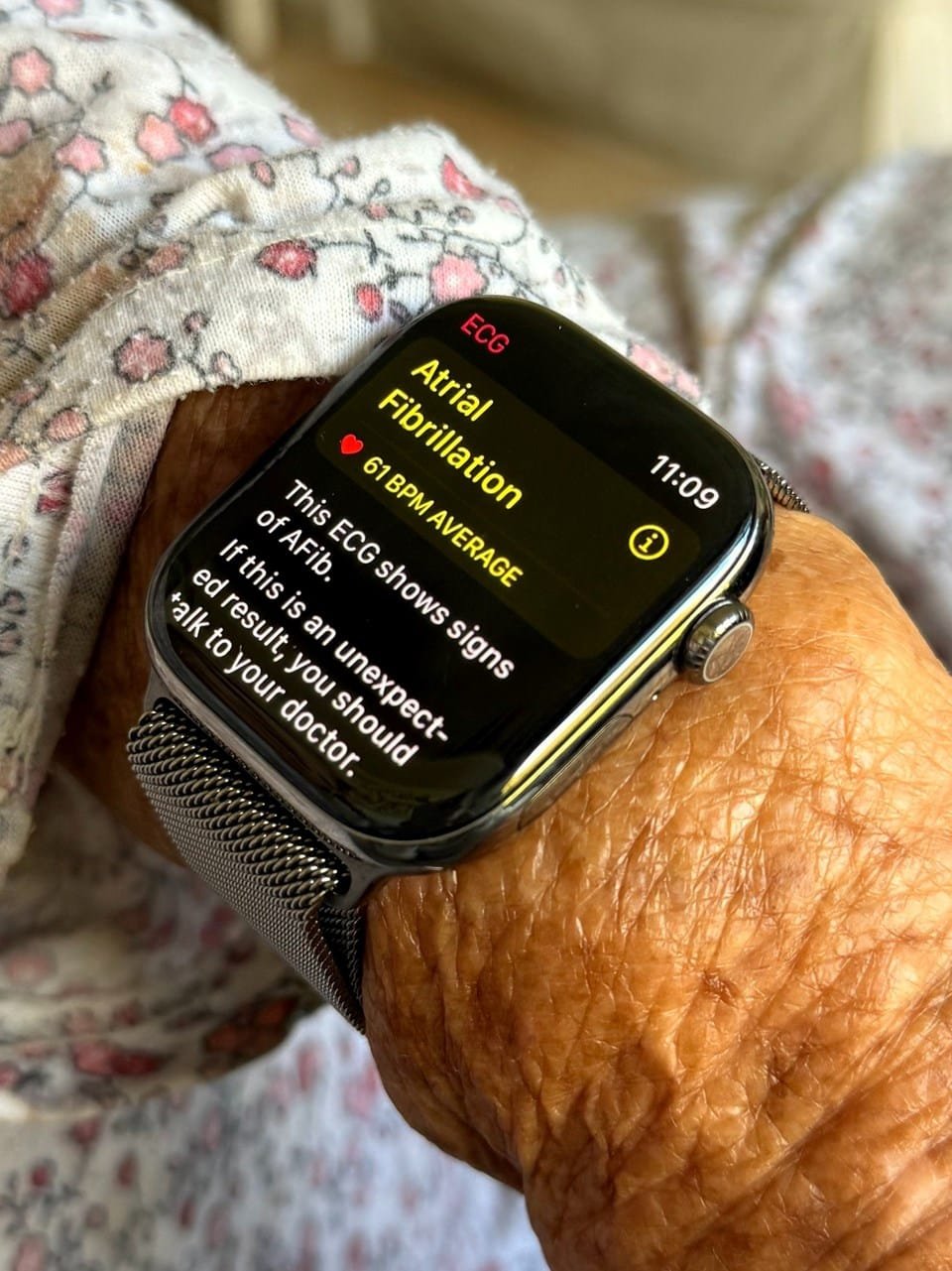 Apple Watch Series 10, Yaşlı Bir Kadının Hayatını Kurtardı